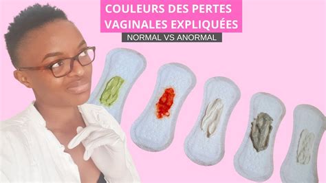 mycose vaginale perte|Mycose et pertes vaginales : symptômes, causes et。